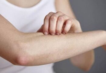 Psoriasia eskuan