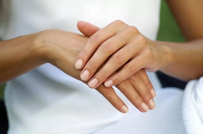 Psoriasia ezkutatzen duen neska